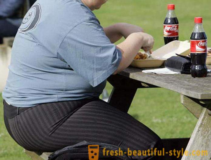 Nutukimo prevencija. Priežastys ir pasekmės nutukimas. Nutukimo problema pasaulyje