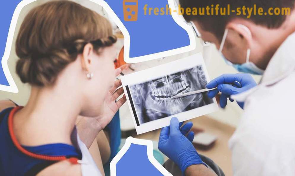4 klausimai apie dantų implantų