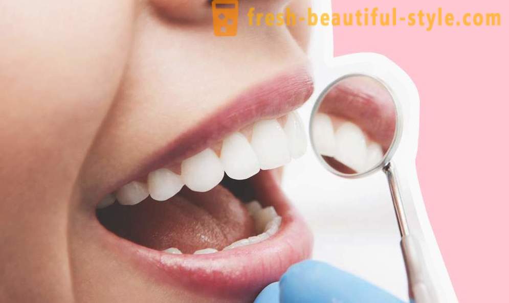 4 klausimai apie dantų implantų