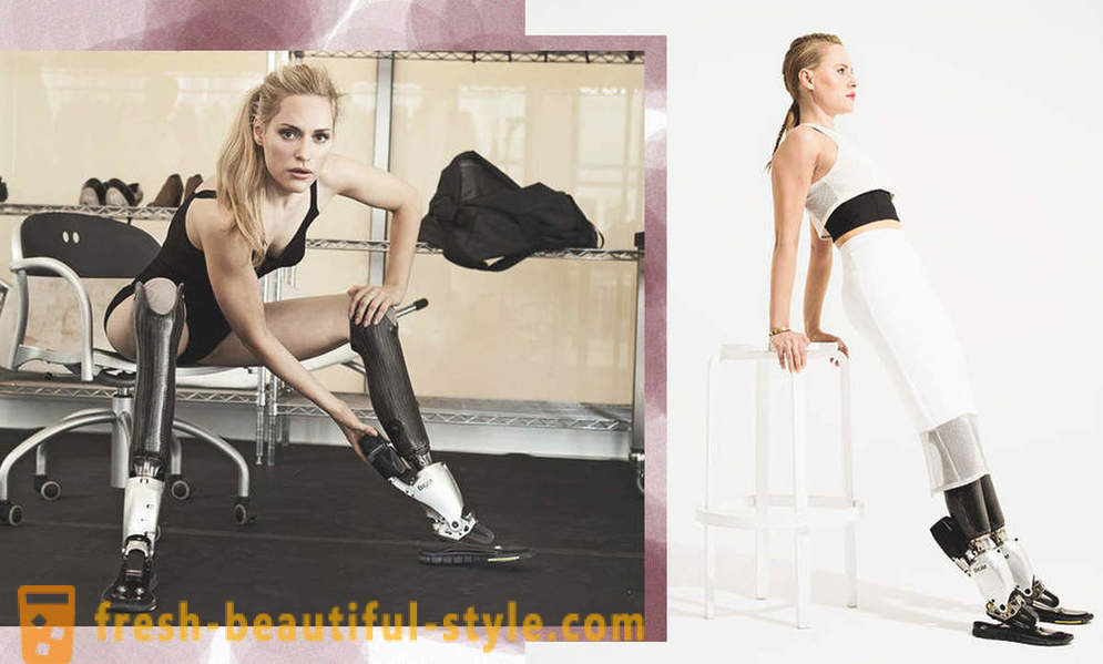 Begalinis grožis: 6 moterys modeliai su protezais
