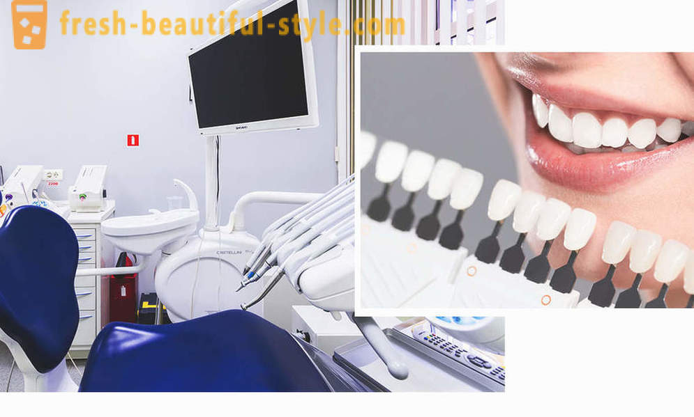 4, idealus būdas padaryti dantis