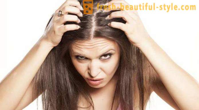 Vaistai, kurių minoksidilas plaukams: apžvalgos, funkcijos ir aprašymas geriausias taikymo